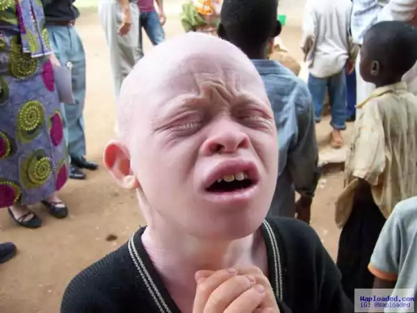 Question Of The Day:- Have You Ever Seen An Hausa Albino Before?